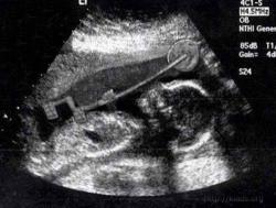 post-32327-0-36195600-1425574205_thumb.j