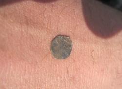 post-5279-0-70840300-1333719201_thumb.jp