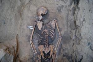 Рис. 5. Погр. 2_береста у левого предплечья.jpg